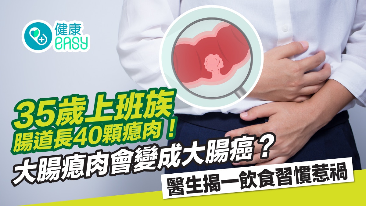 大腸癌｜35歲腸道就長滿瘜肉？ 醫生揭一飲食習慣惹禍！