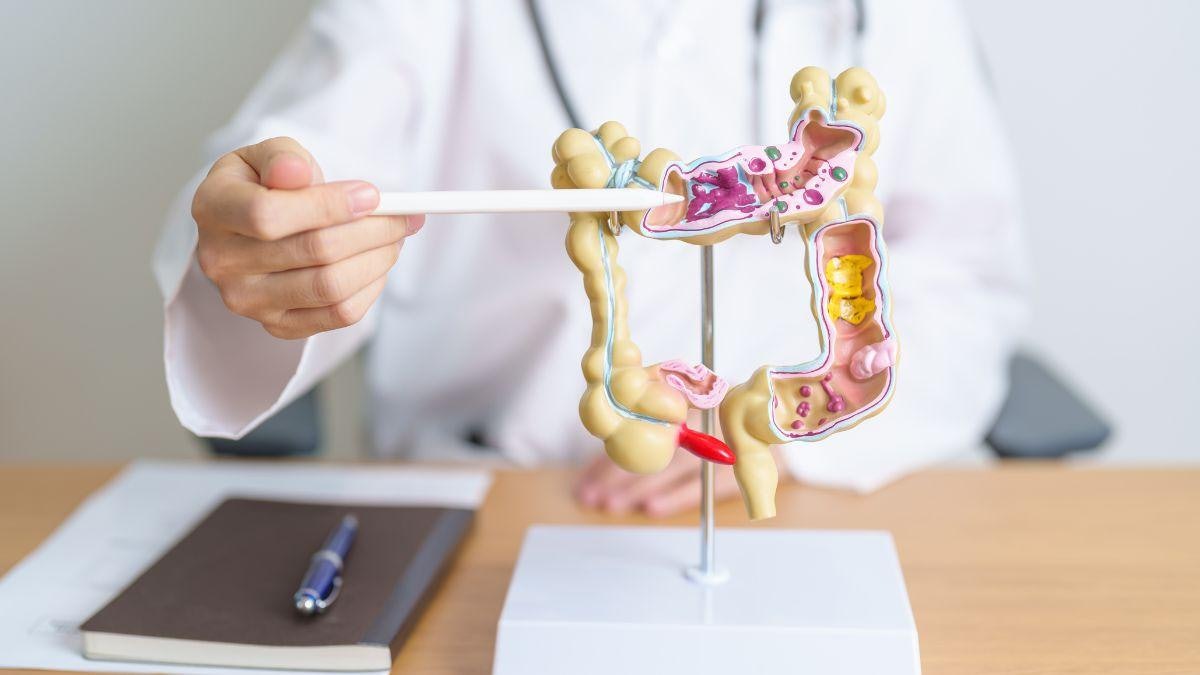 大腸鏡|多久做一次?哪族群屬高風險?沒問3個問題「等於白做」 大腸鏡|多久做一次?哪族群屬高風險?沒問3個問題「等於白做」