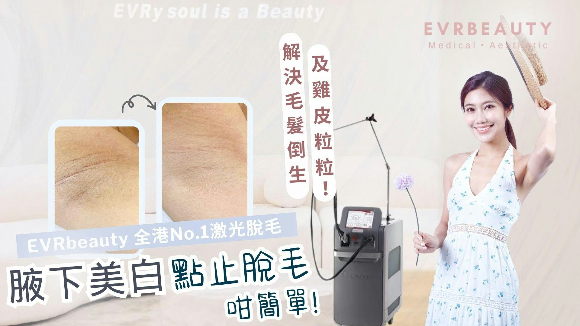 腋下 腋下美白｜夏天唔想舉手尷尬？天然方法擊退黑色素快速美白腋下