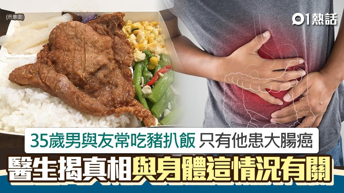 35歲男跟朋友常吃豬扒飯 僅他患大腸癌 醫生:與身體這情況有關 35歲男跟朋友常吃豬扒飯 僅他患大腸癌 醫生:與身體這情況有關