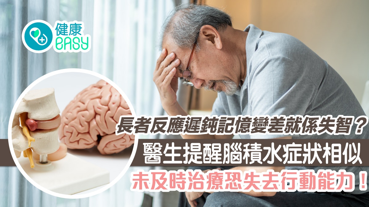 腦積水|老人反應遲鈍記憶變差是失智?1病症若不治療恐長期臥床 腦積水|老人反應遲鈍記憶變差是失智?1病症若不治療恐長期臥床