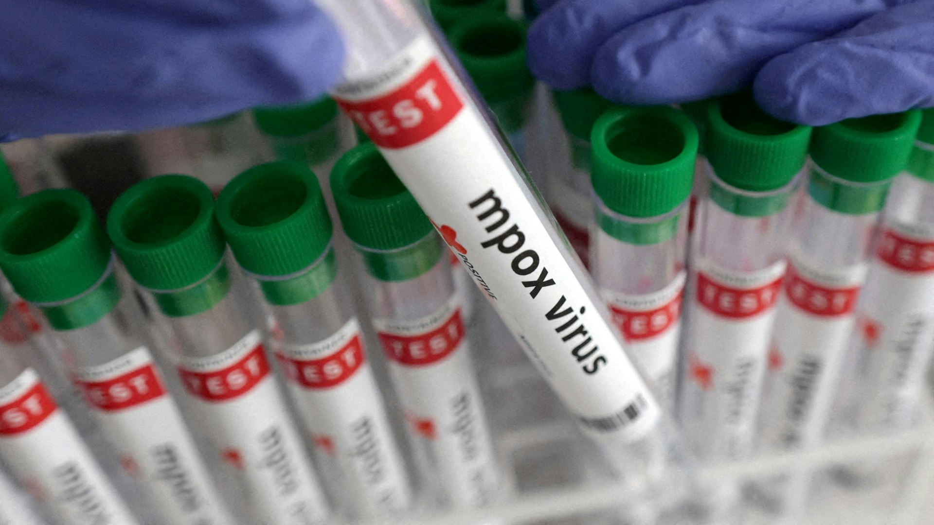 圖為2024年8月20日路透社拍攝的設計圖片中,有貼上「猴痘(Mpox)病毒檢測結果呈陽性」標籤的試管。