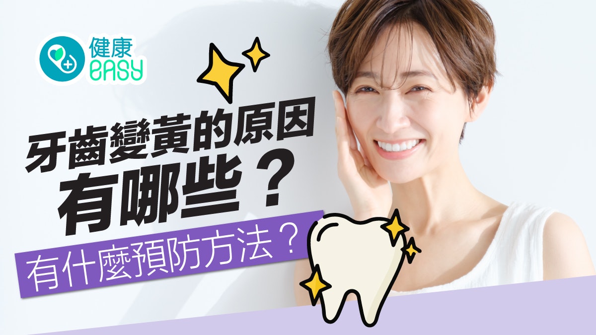 牙齒健康|牙齒變黃點算好?盤點7大原因預防牙齒不變色要這樣做 牙齒健康|牙齒變黃點算好?盤點7大原因預防牙齒不變色要這樣做