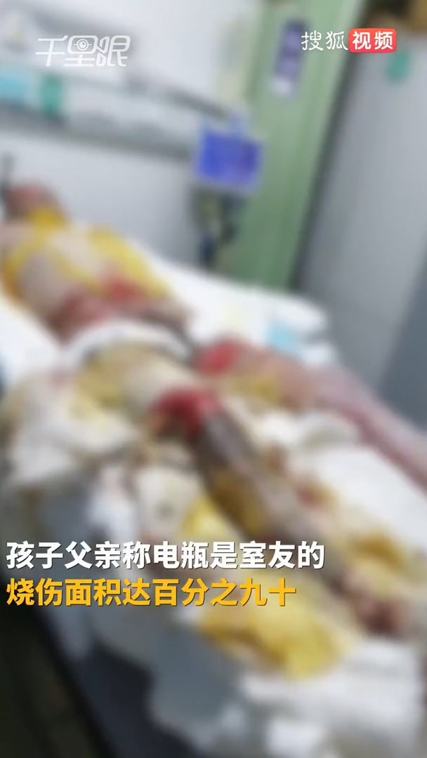 一名大學生全身九成皮膚燒傷。（影片截圖）