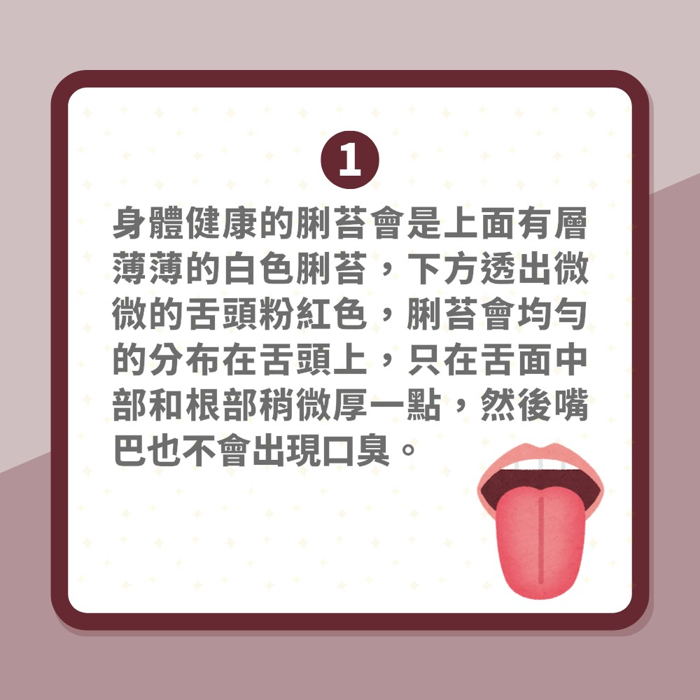 5種脷苔顏色揭穿你健康狀況　發黑係咩意思？口臭肝火旺點下火？（01製圖）