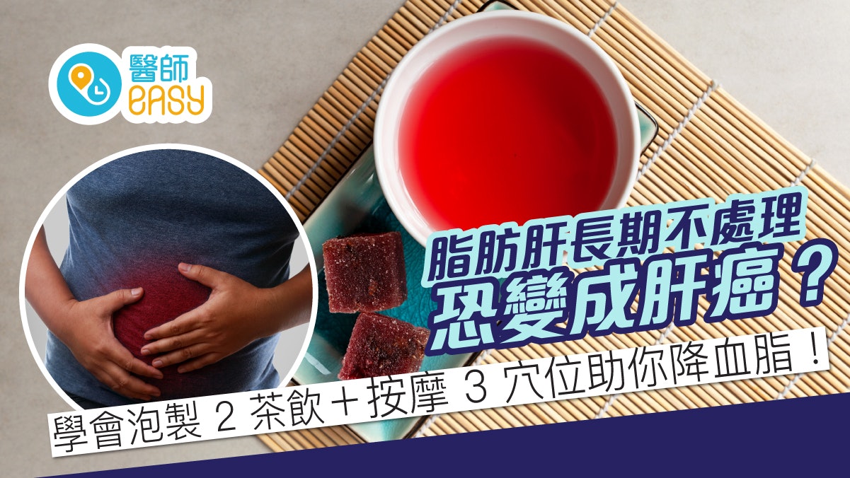脂肪肝長期不處理恐變成肝癌?自製2茶飲助消脂、按3穴位降血脂 脂肪肝長期不處理恐變成肝癌?自製2茶飲助消脂、按3穴位降血脂