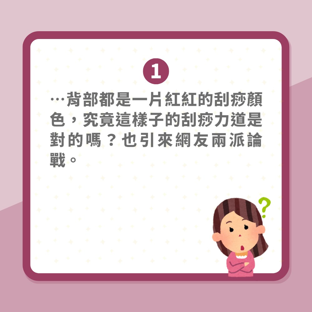 鄭秀文刮痧背部全紅代表什麼意思？有助瘦身？四大注意事項你要知（01製圖）