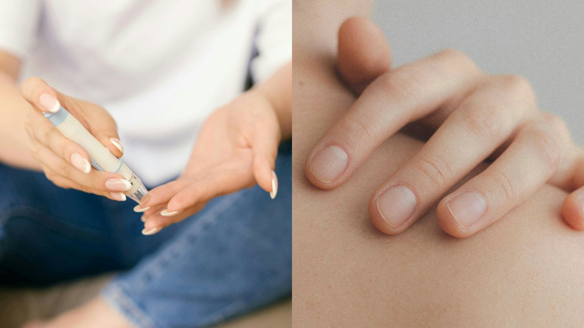 皮膚粗糙黑了一片不是沒洗乾淨?皮膚科醫生解密:恐是糖尿病徵兆 皮膚粗糙黑了一片不是沒洗乾淨?皮膚科醫生解密:恐是糖尿病徵兆