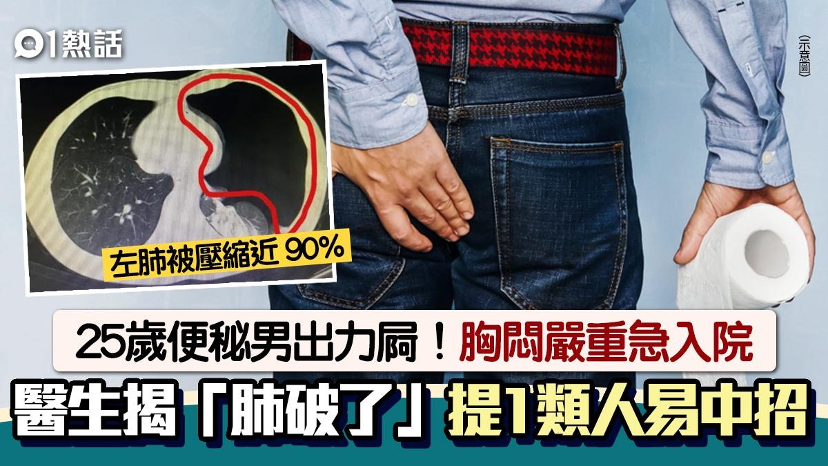 25歲男便秘！用力過度谷爆肺　破口大到做手術　醫生指3症狀小心