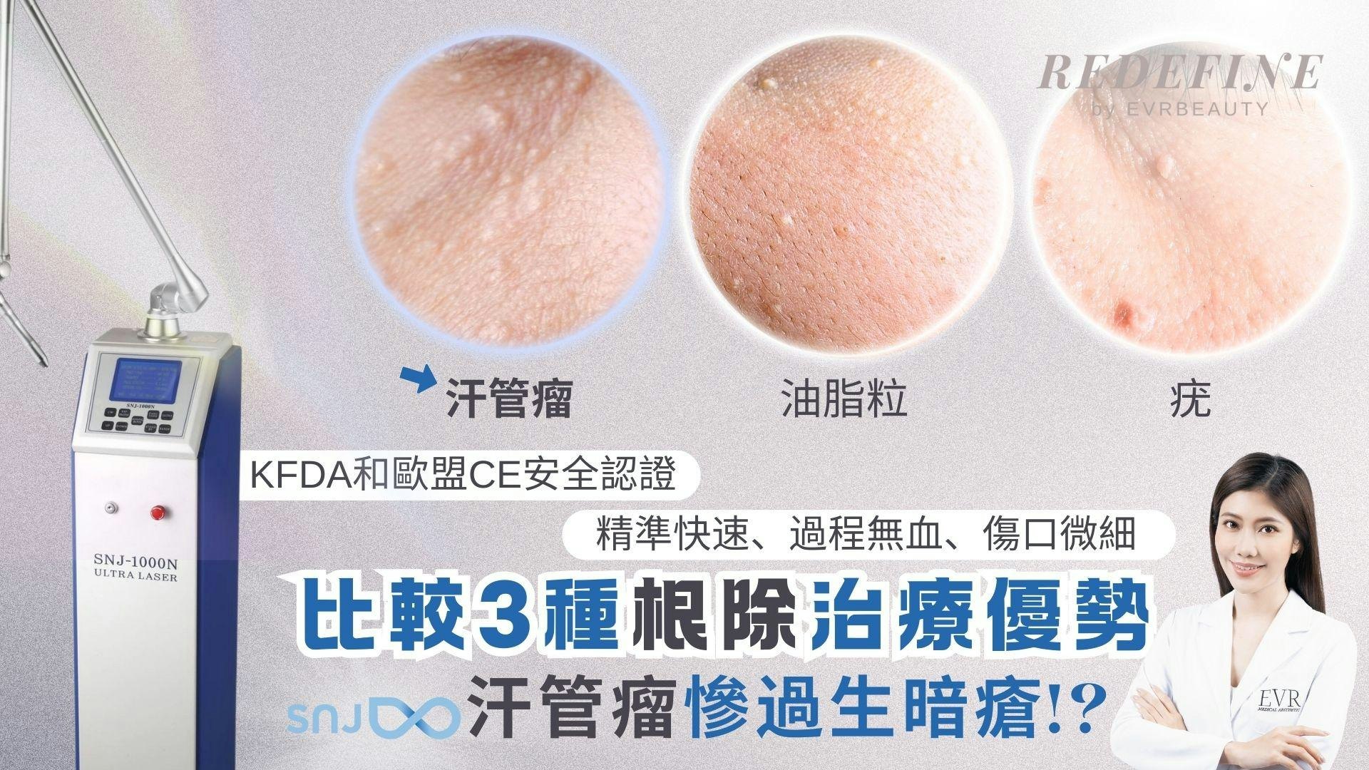 汗管瘤|眼下半透明凸出顆粒是油脂粒?生疣?3種去除汗管瘤方法 汗管瘤|眼下半透明凸出顆粒是油脂粒?生疣?3種去除汗管瘤方法