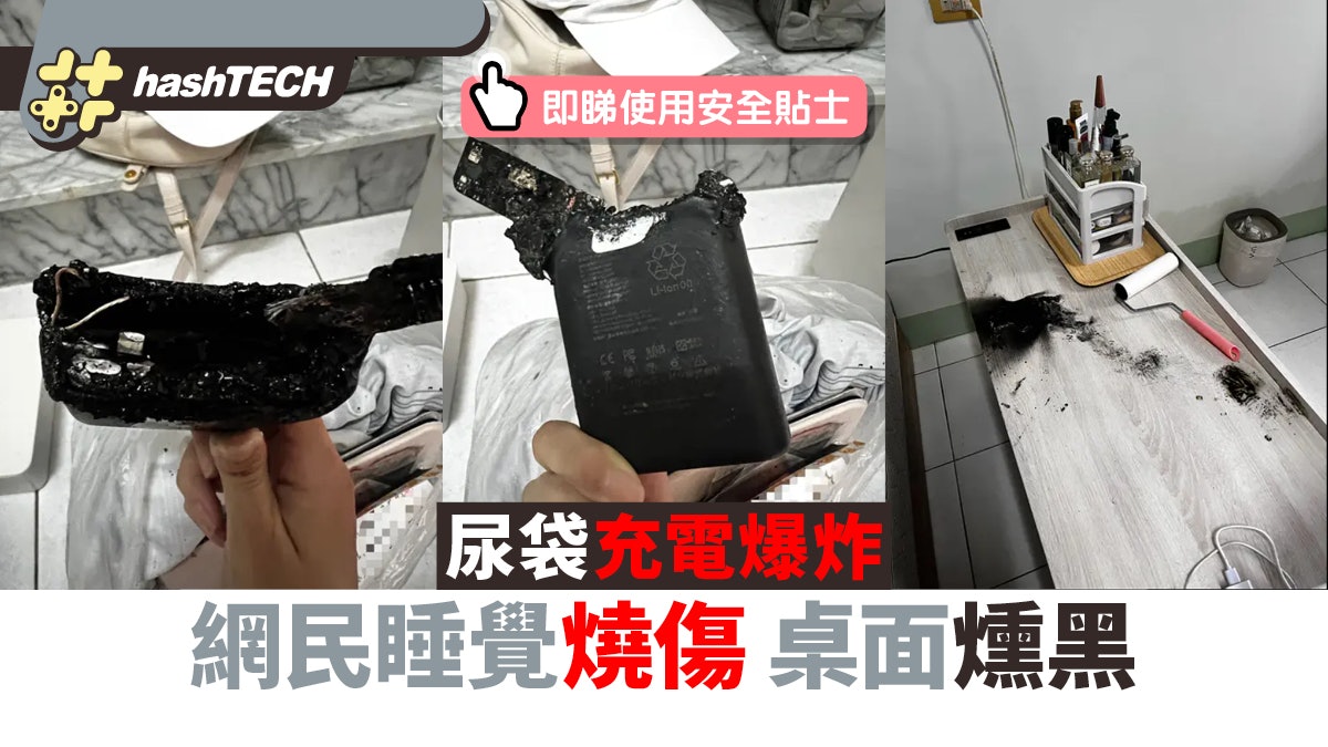 尿袋充電爆炸|網民睡覺燒傷桌面燻黑 即睇行動電源使用安全貼士 尿袋充電爆炸|網民睡覺燒傷桌面燻黑 即睇行動電源使用安全貼士
