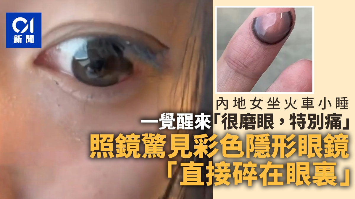 女子坐火車睡著被痛醒 照鏡嚇壞 隱形眼鏡竟「直接碎在眼裏」 女子坐火車睡著被痛醒 照鏡嚇壞 隱形眼鏡竟「直接碎在眼裏」