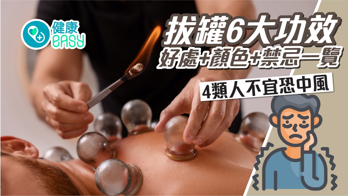 拔罐|6大功效好處+顏色+禁忌一覽!4類人不宜恐中風 拔罐|6大功效好處+顏色+禁忌一覽!4類人不宜恐中風