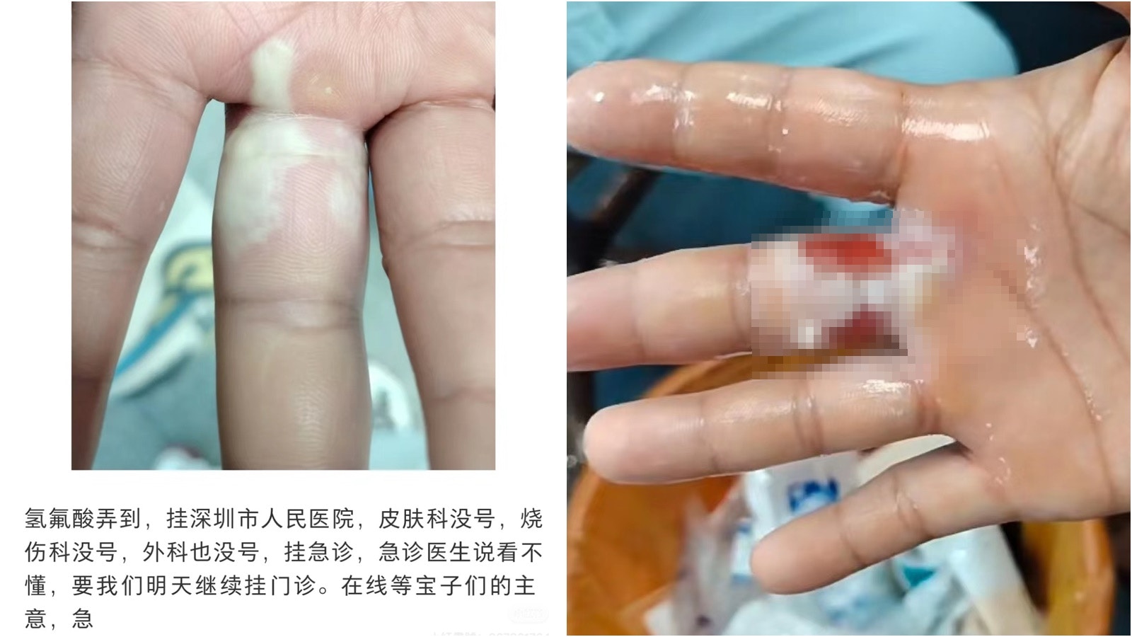 中國醫科博士馬爾代夫浮潛溺亡女友含淚控訴：他是家中獨子