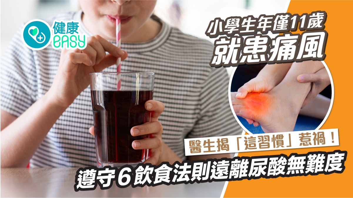 痛風飲食|小學生都會患痛風?一文話你知控制尿酸怎樣吃! 痛風飲食|小學生都會患痛風?一文話你知控制尿酸怎樣吃!