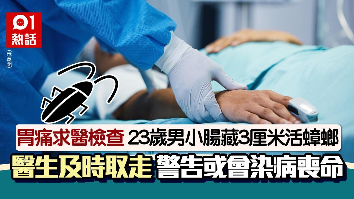 23歲男胃痛求診 醫生驚揭小腸藏3厘米活蟑螂 未及取走隨時斃命 23歲男胃痛求診 醫生驚揭小腸藏3厘米活蟑螂 未及取走隨時斃命