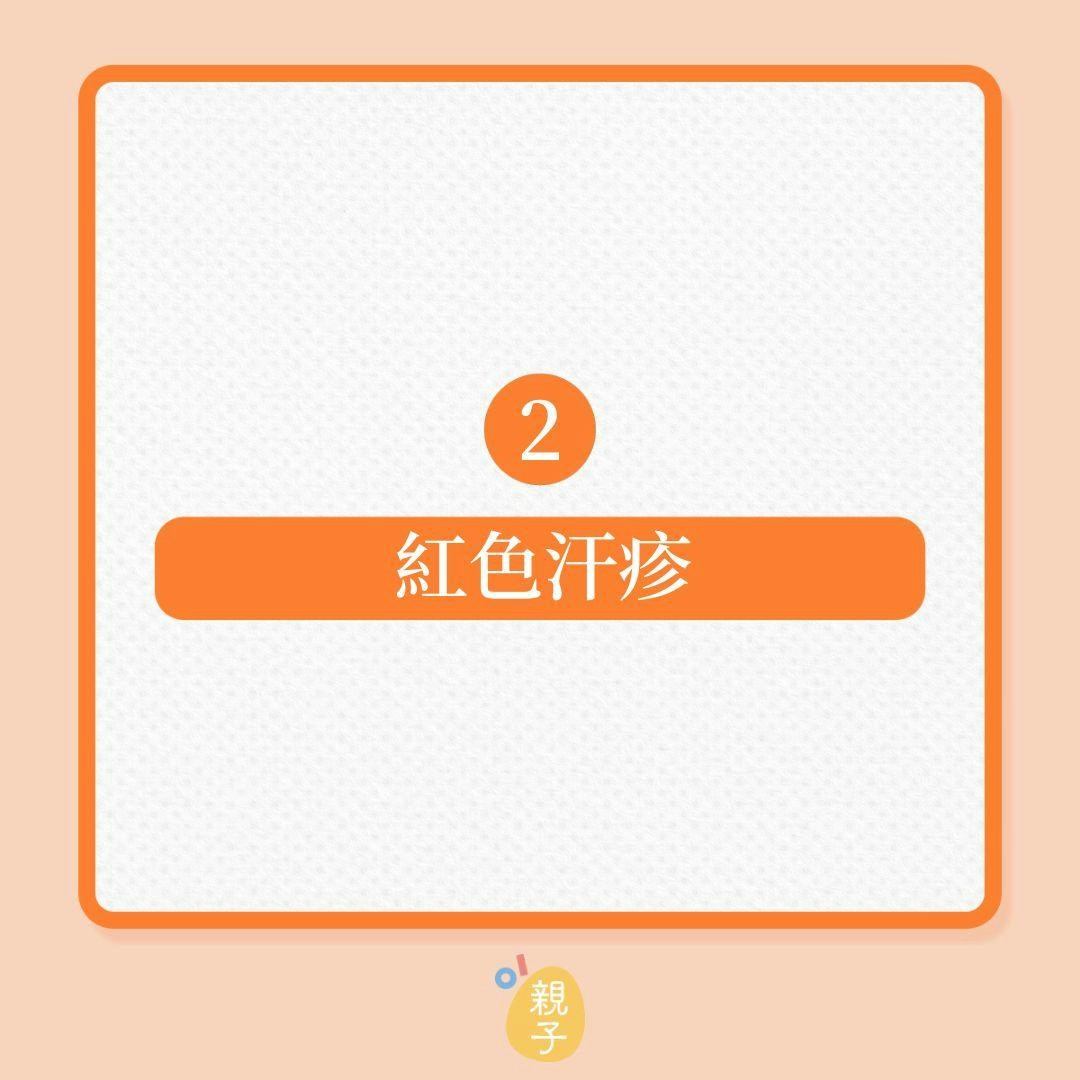 兒童皮膚健康｜3種常見汗疹！（01製圖）