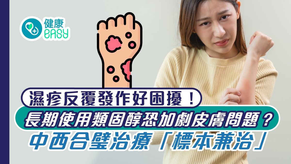 濕疹|長期使用類固醇加劇皮膚問題?中西醫結合治療達標本兼治 濕疹|長期使用類固醇加劇皮膚問題?中西醫結合治療達標本兼治