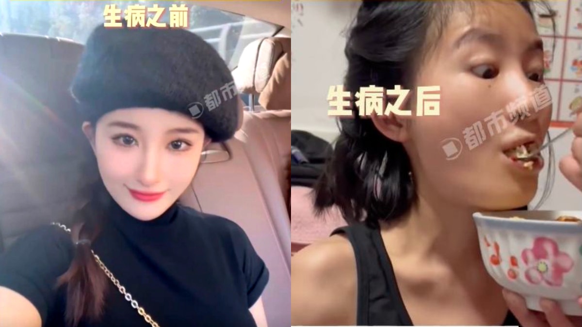 陽光美少女突患怪病「手抬不起來」竟是漸凍症 拍紀錄片激勵他人 陽光美少女突患怪病「手抬不起來」竟是漸凍症 拍紀錄片激勵他人