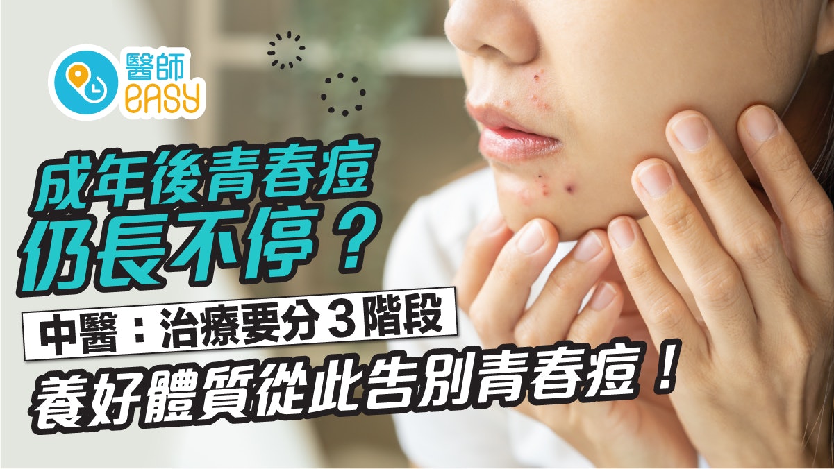暗瘡|30歲過了青春期仍長痘痘?中藥「三階段治療」調理出好體質