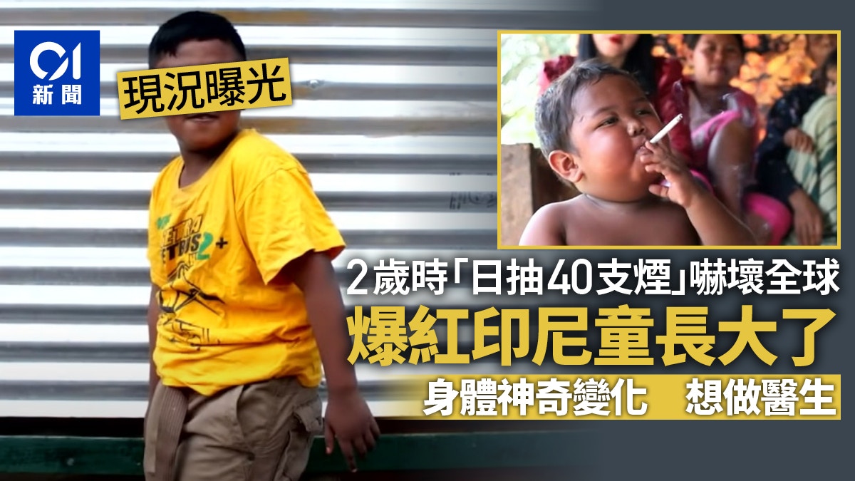 印尼“2岁抽烟”男童曾吓坏全球 16岁现况曝光