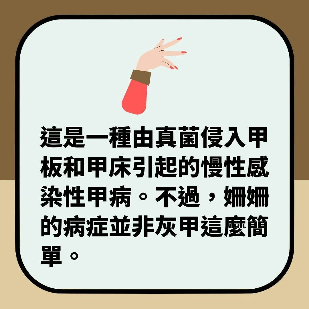 內地美甲愛好者指甲驚現「立體海神三叉戟」　醫生警告：快切除！（01製圖）