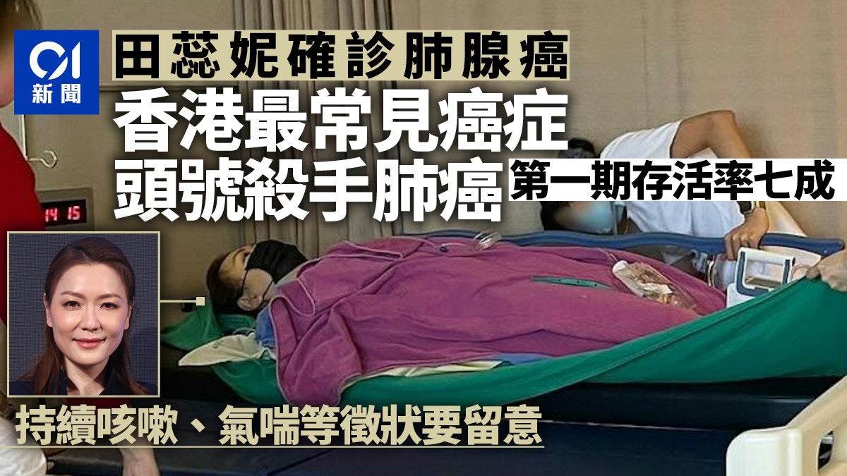 田蕊妮患肺癌｜港台癌症頭號殺手　第一期存活率七成　即睇徵狀