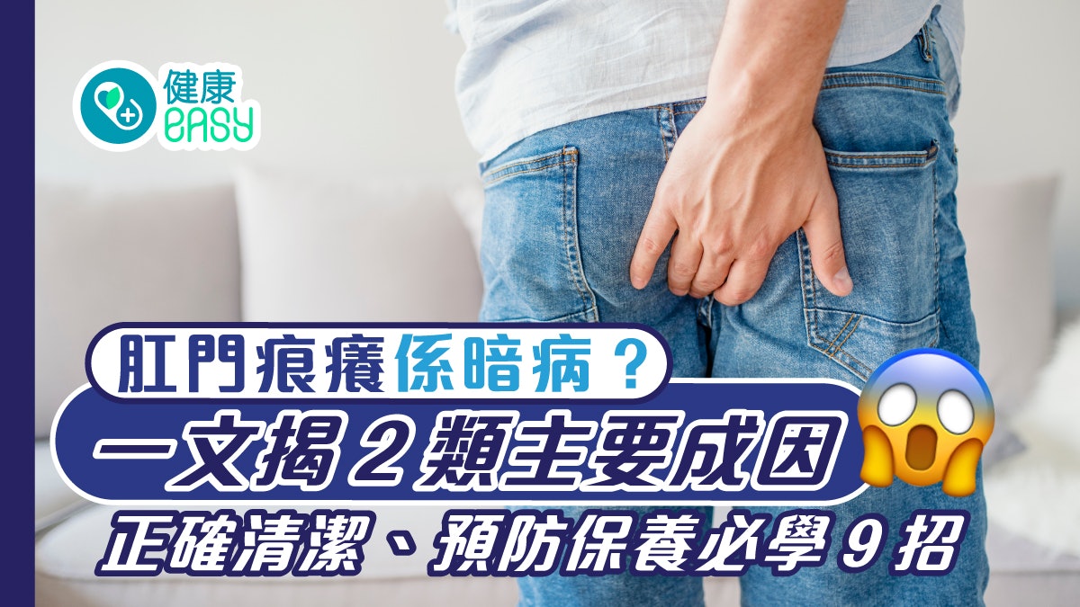 肛門痕癢|夜間發癢影響睡眠?必學正確清潔步驟、7保養預防重點 肛門痕癢|夜間發癢影響睡眠?必學正確清潔步驟、7保養預防重點