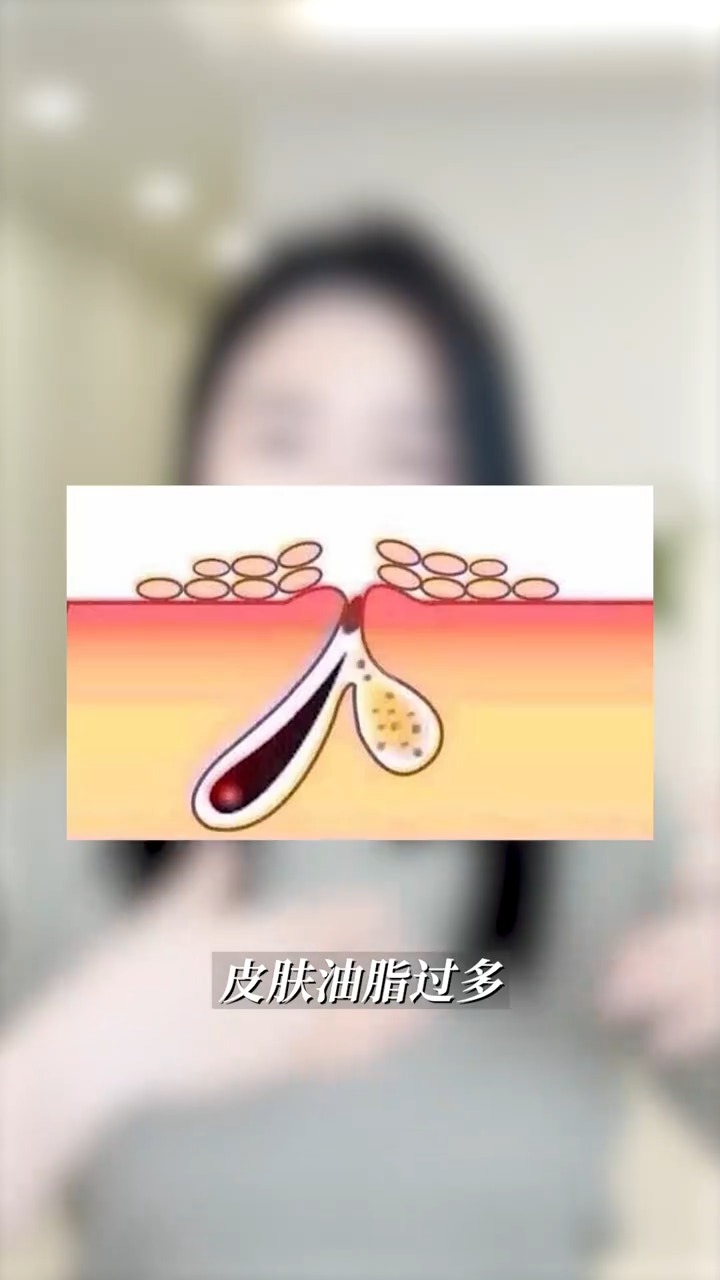 「乳霜油紙面膜法」只需要準備自己慣用的乳霜及吸油面紙，利用吸油面紙將毛孔內的髒污帶走，再由乳霜深層補水（小紅書＠李藝恩 Dr.meili）