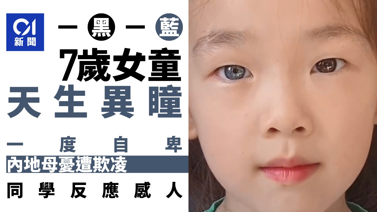 7歲女童「天生異瞳」雙眼一黑一藍母擔心被欺凌同學反應感人