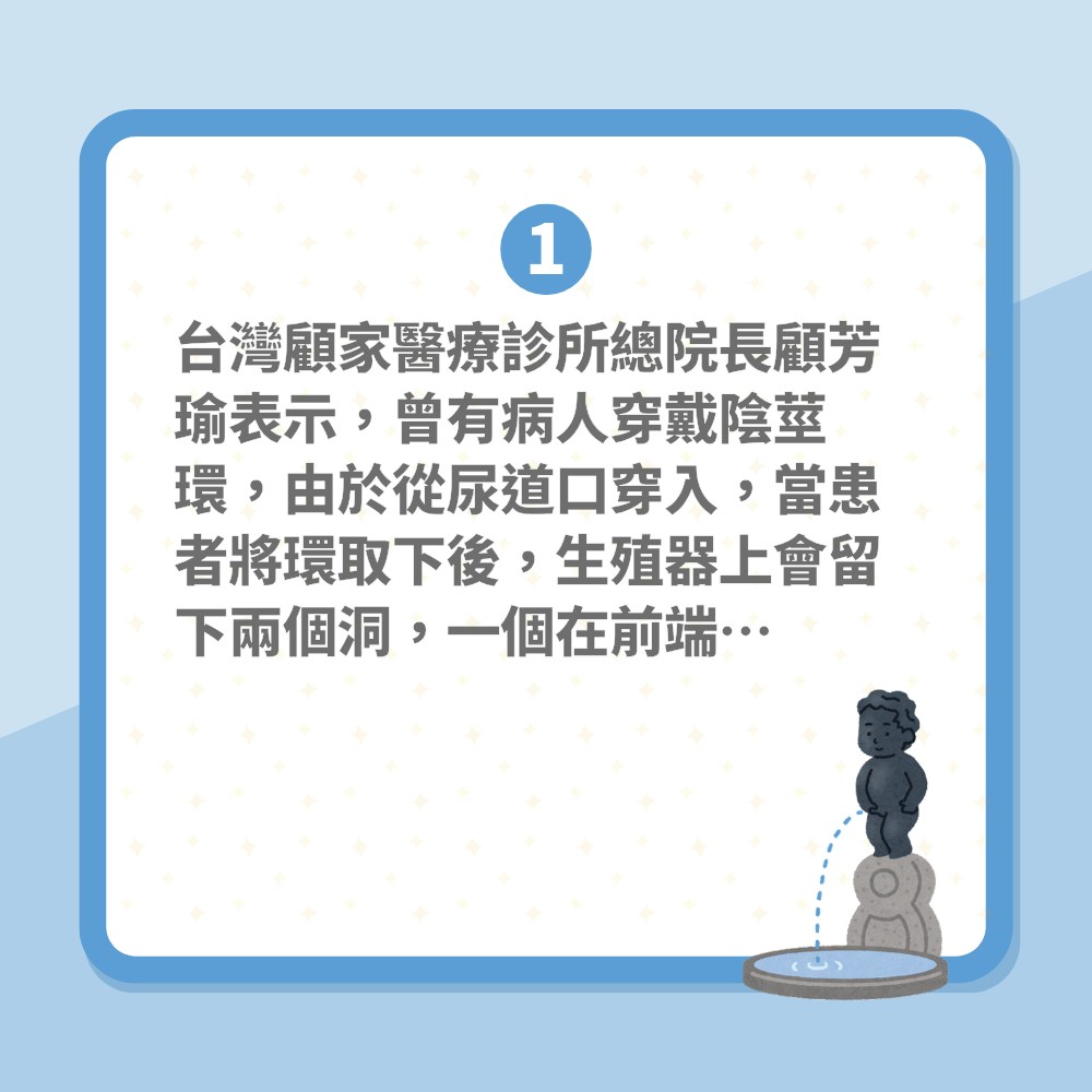 陰莖環｜陽具穿環後小便「尿亂噴」更影響性生活　專家教這樣補救（01製圖）