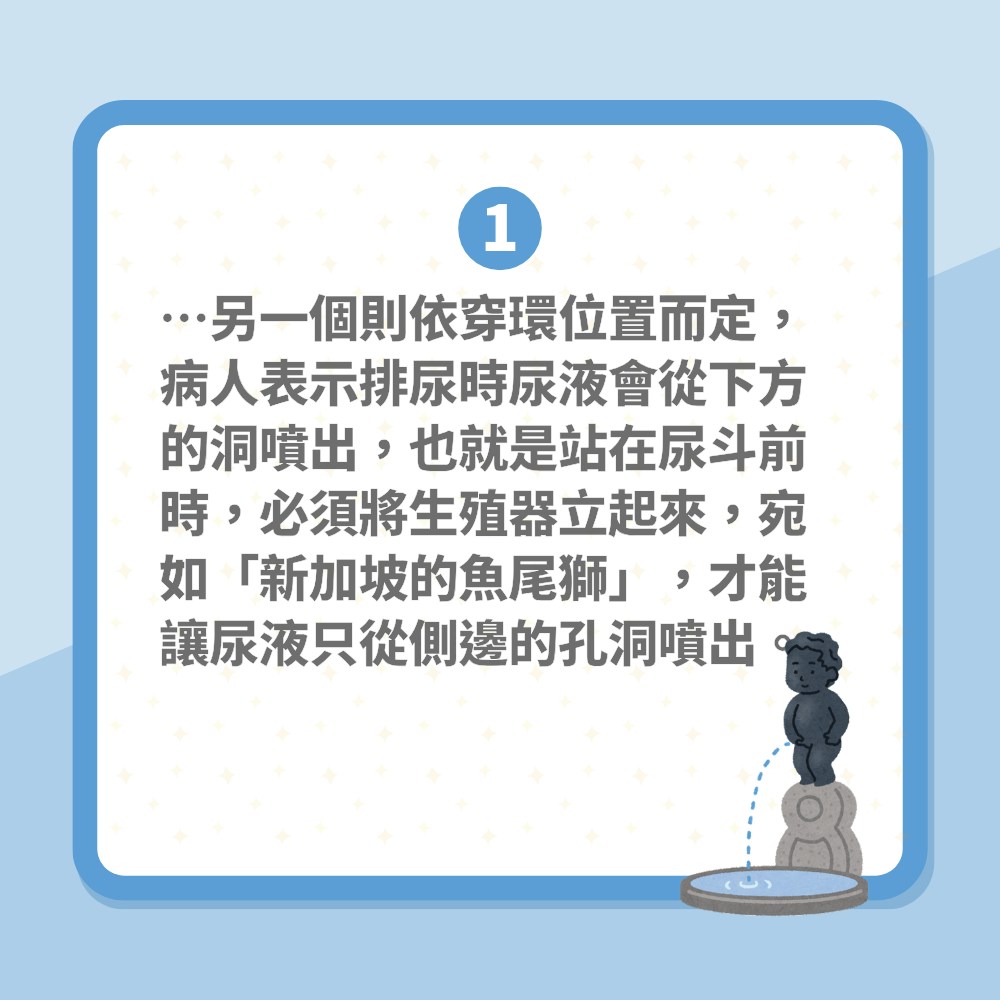 陰莖環｜陽具穿環後小便「尿亂噴」更影響性生活　專家教這樣補救（01製圖）