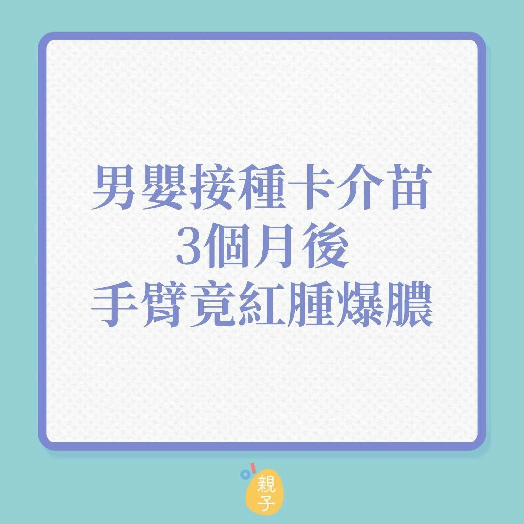 男嬰接卡介苗，3個月後手臂竟紅腫爆膿！（01製圖）