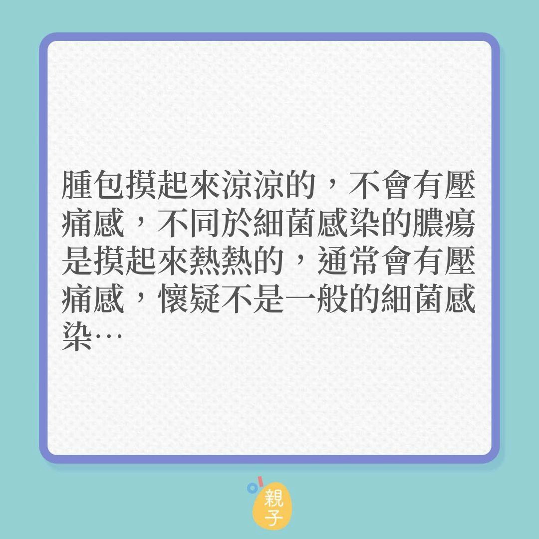 男嬰接卡介苗，3個月後手臂竟紅腫爆膿！（01製圖）