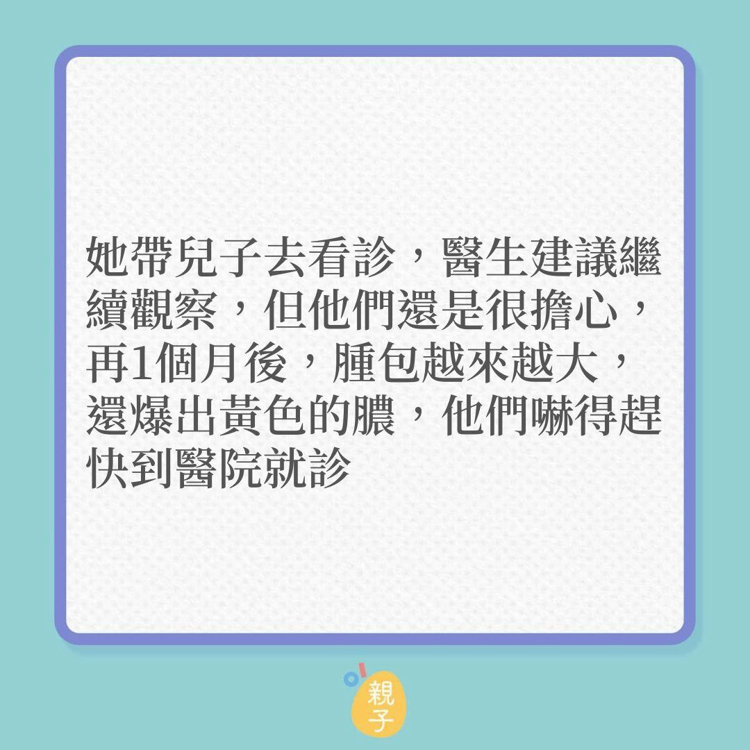 男嬰接卡介苗，3個月後手臂竟紅腫爆膿！（01製圖）