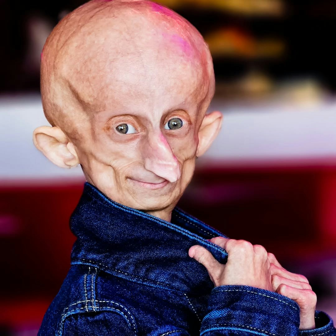 罹患早衰症的少女班德莉。(Instagram / @bb_unique_2005)