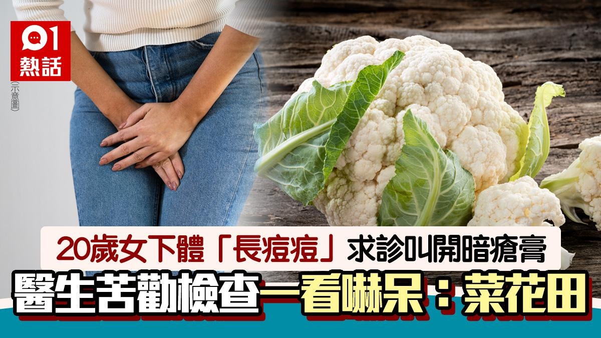 20歲女下體「長痘痘」求診要暗瘡膏 醫生一看秒嚇呆:整片菜花田 20歲女下體「長痘痘」求診要暗瘡膏 醫生一看秒嚇呆:整片菜花田