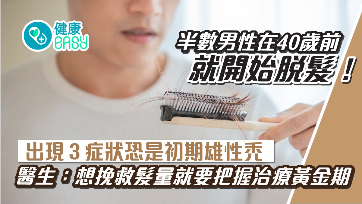 脫髮|髮量變少雄性禿3症狀!2部位髮質軟塌要小心把握挽救黃金期 脫髮|髮量變少雄性禿3症狀!2部位髮質軟塌要小心把握挽救黃金期