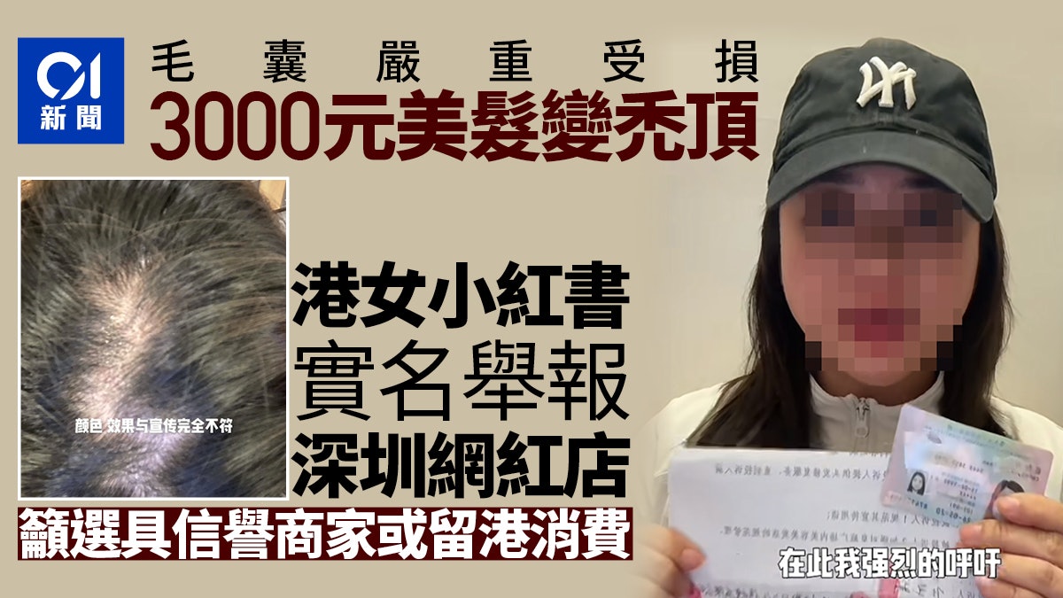 港女舉報深圳花3千美髮變禿頂 髮型師回應01:去年已退款兼和解 港女舉報深圳花3千美髮變禿頂 髮型師回應01:去年已退款兼和解