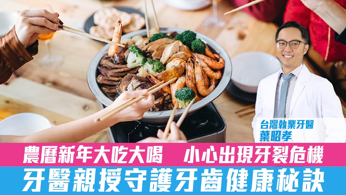 農曆新年大吃大喝 小心出現牙裂危機 牙醫親授守護牙齒健康秘訣 農曆新年大吃大喝 小心出現牙裂危機 牙醫親授守護牙齒健康秘訣