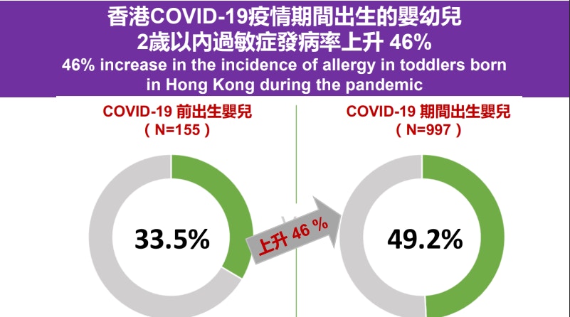 研究指出，疫情期間出生的嬰兒過敏症發病率達49.2%，比疫情前出生的嬰兒高46%。（中大醫學院提供）