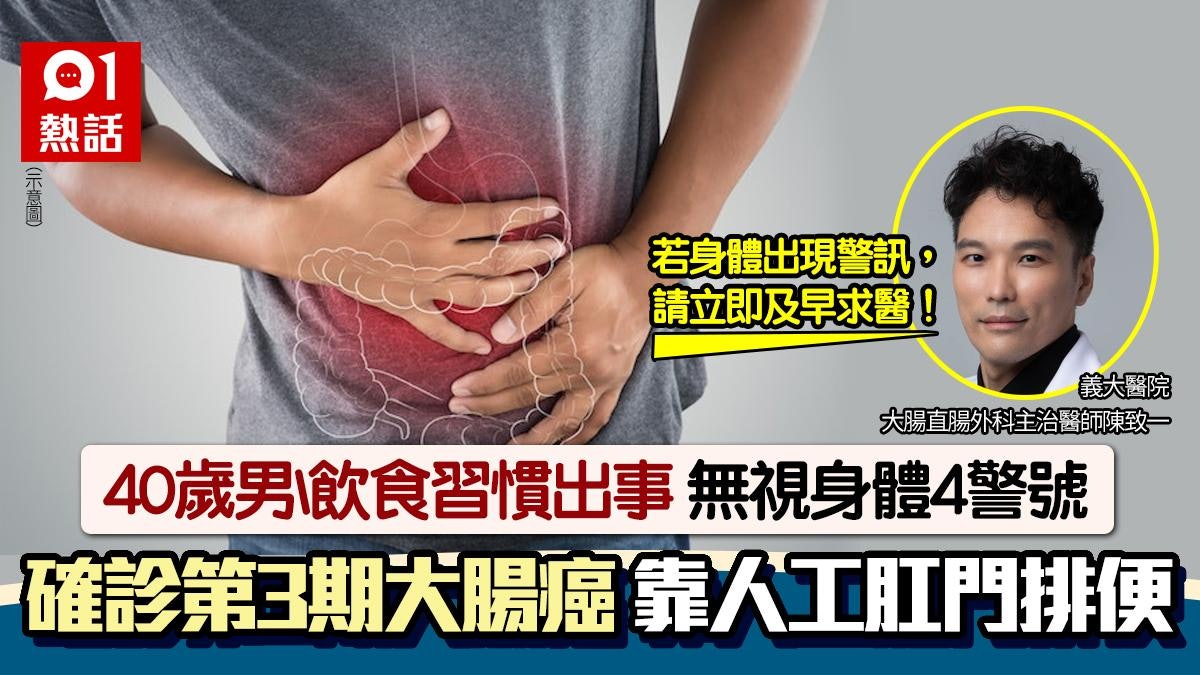 40歲男飲食習慣這樣差!忽視身體4警號 驚患大腸癌要用人工肛門 40歲男飲食習慣這樣差!忽視身體4警號 驚患大腸癌要用人工肛門