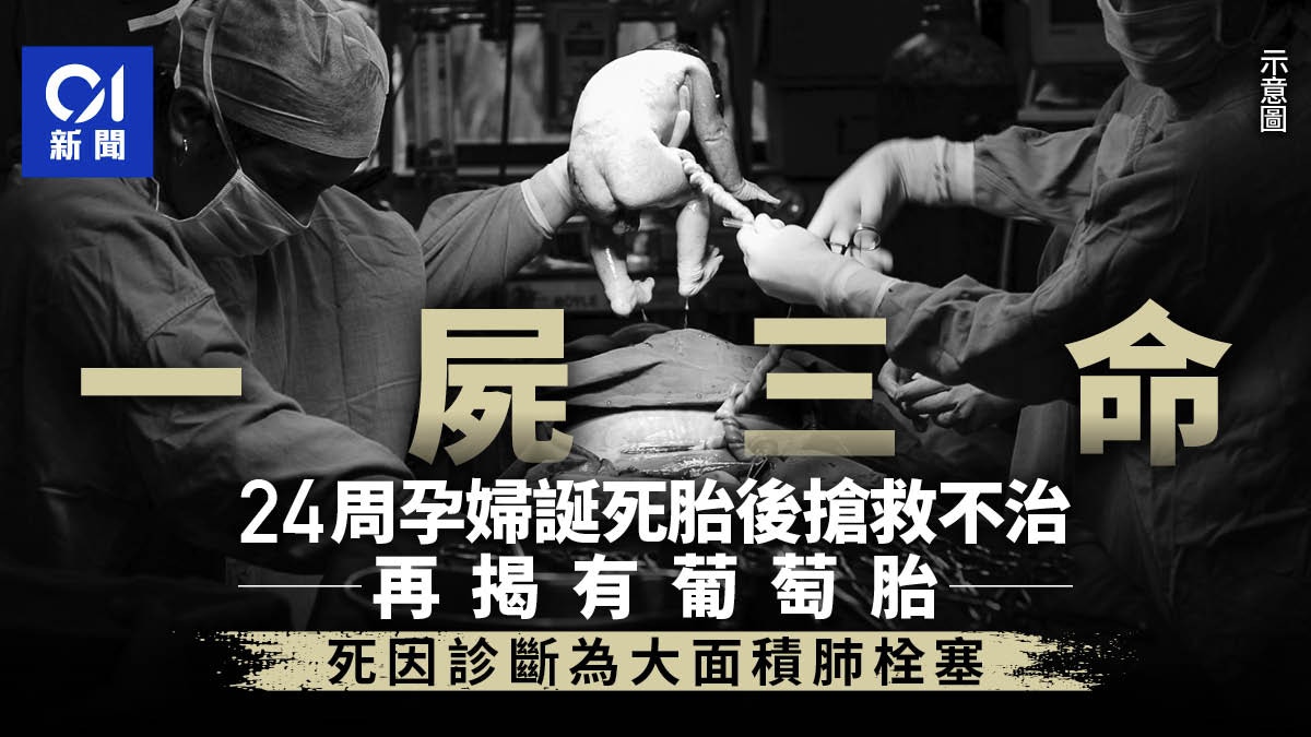 一屍三命|懷孕24周孕婦急送院 誕死胎後搶救不治 再揭有葡萄胎
