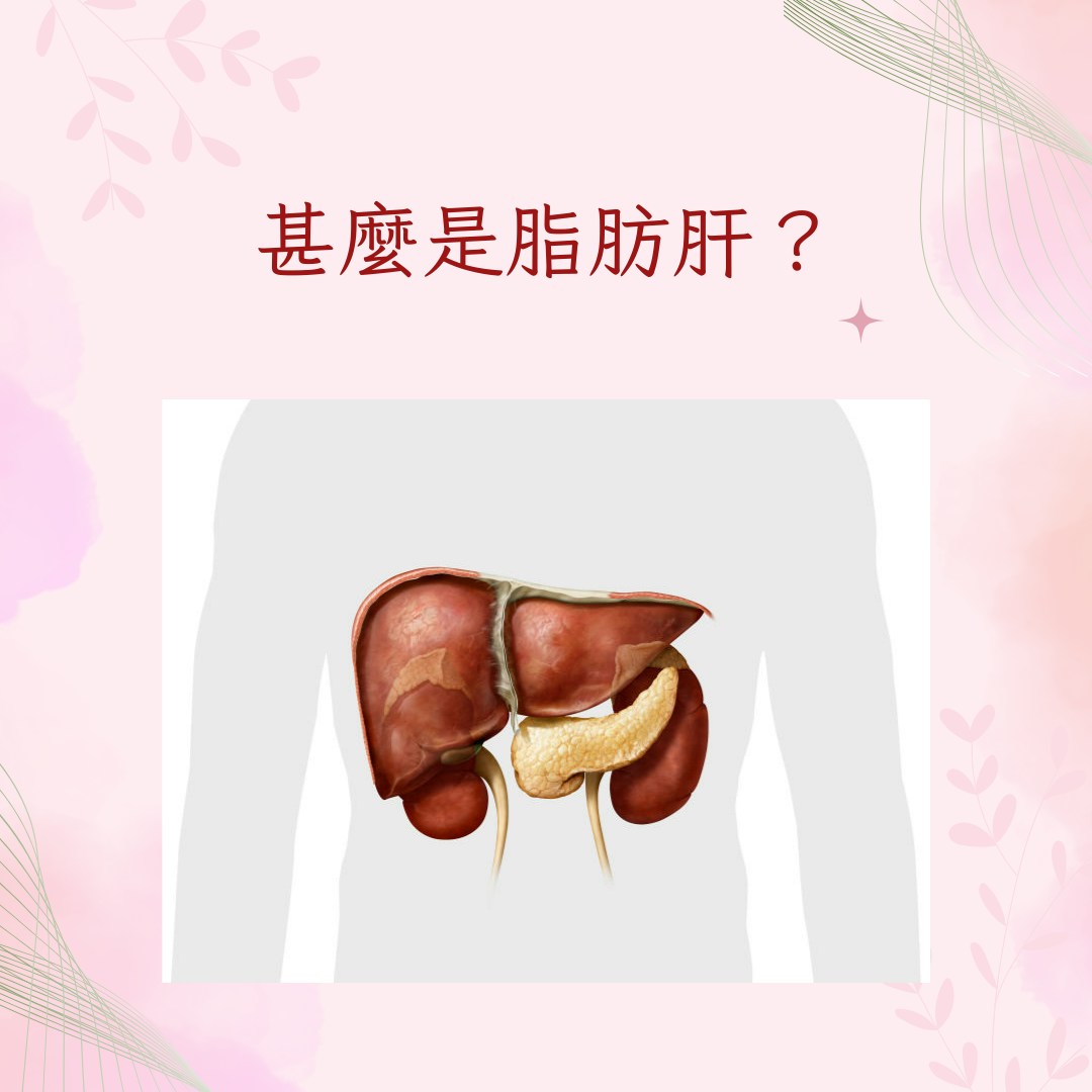 【減走脂肪肝4大方法】甚麼是脂肪肝？（Gettyimages；01製圖）