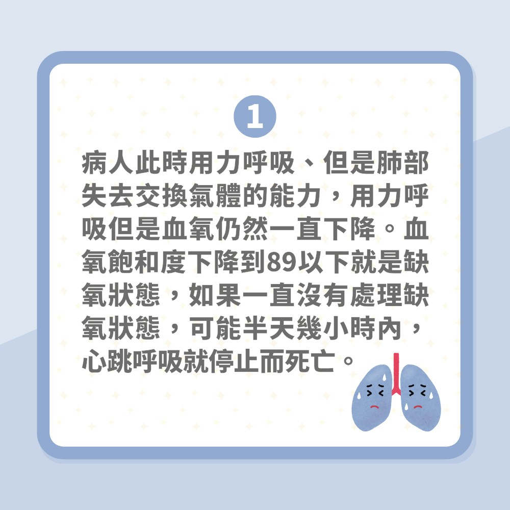 大S徐熙媛流感肺炎去世｜台醫揭「白肺」可怕之處：被痰活活淹死（01製圖）