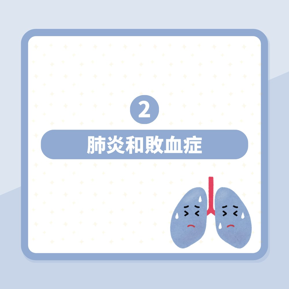 大S徐熙媛流感肺炎去世｜台醫揭「白肺」可怕之處：被痰活活淹死（01製圖）