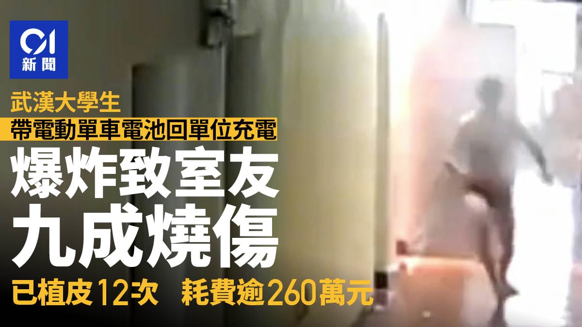 大學生帶電瓶回單位充電爆炸致室友9成燒傷 已花260多萬植皮12次 大學生帶電瓶回單位充電爆炸致室友9成燒傷 已花260多萬植皮12次