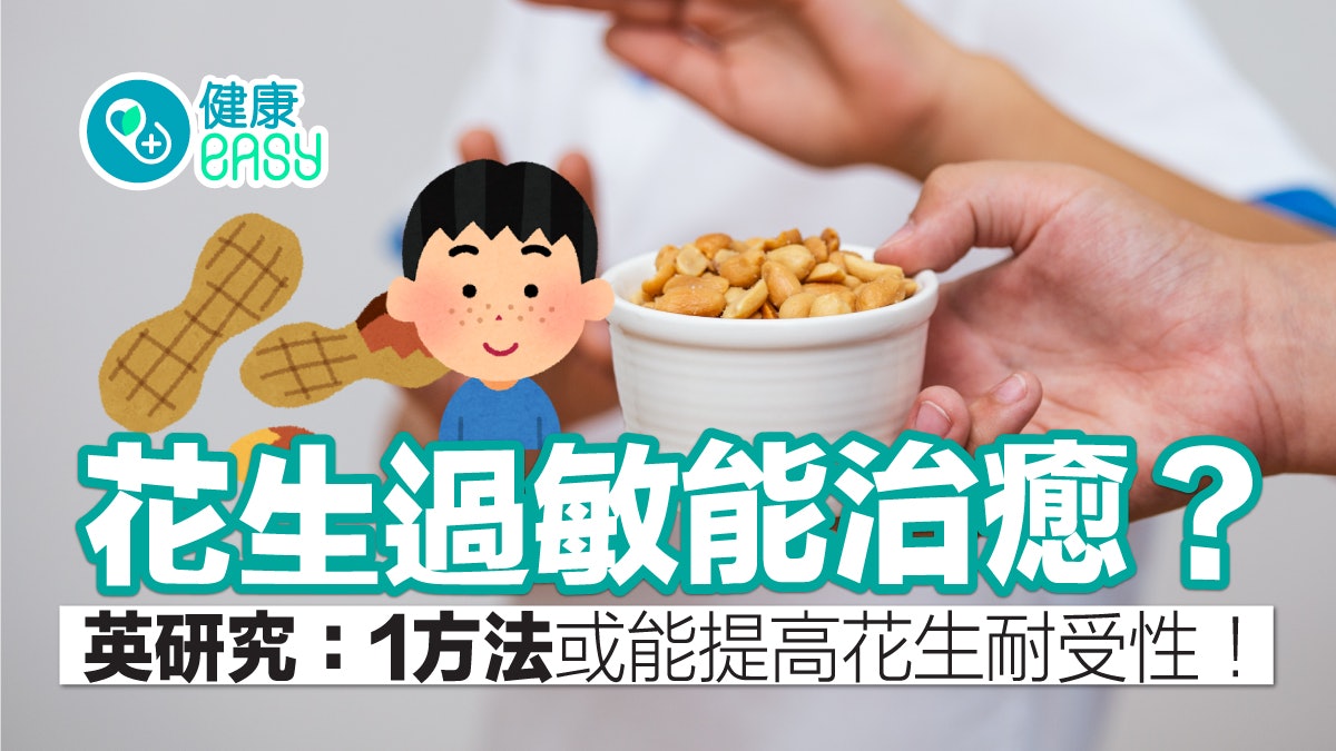 食物過敏|花生過敏能治癒?英研究:1方法或能提高花生耐受性! 食物過敏|花生過敏能治癒?英研究:1方法或能提高花生耐受性!