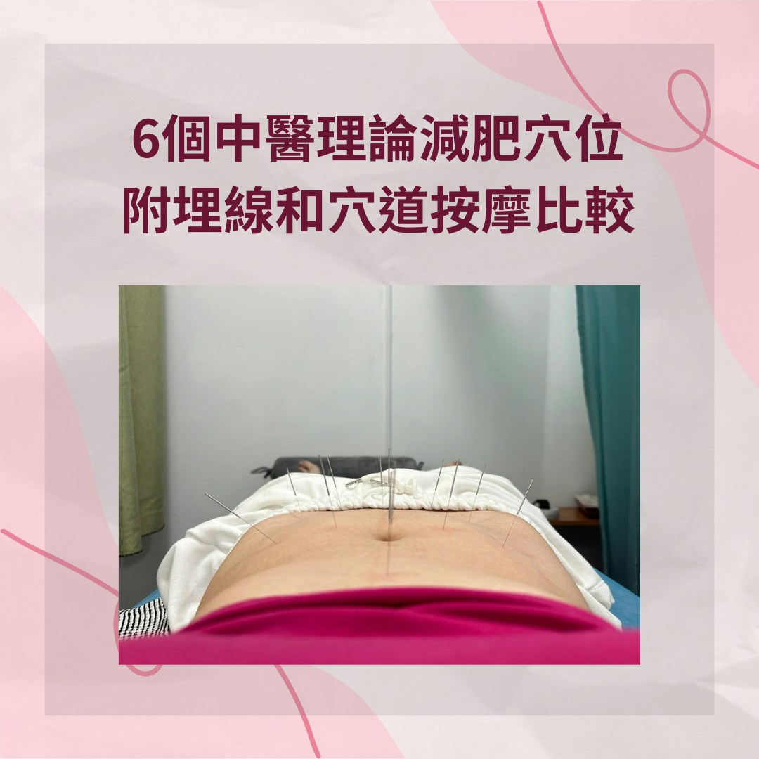 6個中醫理論減肥穴位　附埋線和穴道按摩比較（小紅書@你餓不餓我餓；01製圖）