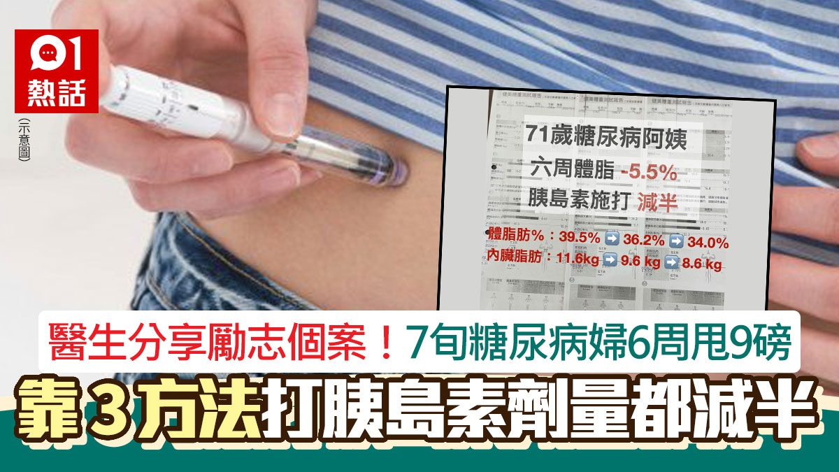 糖尿病七旬婦6周甩9磅!醫生爆勵志個案 靠3方法減體脂穩定血糖